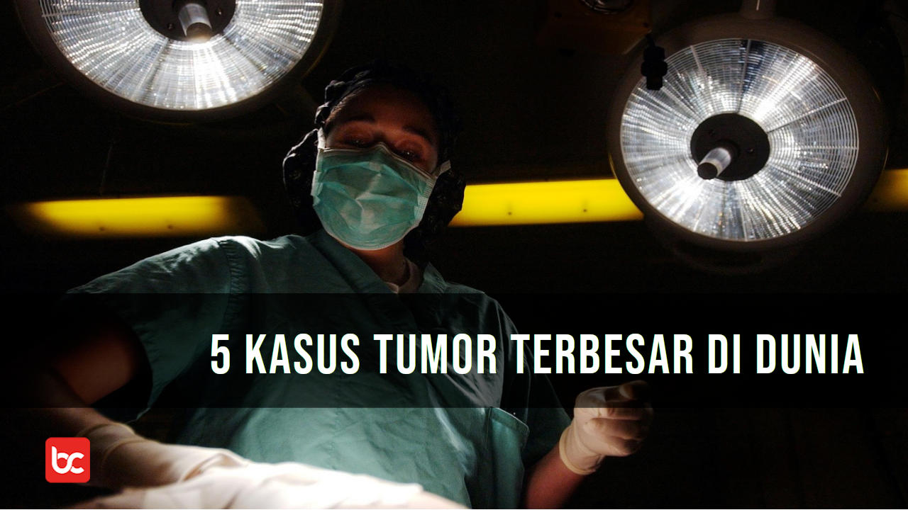 5 Kasus Tumor Terbesar di Dunia