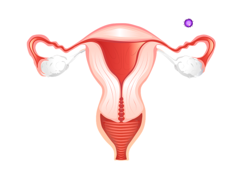 Kasus tumor terbesar