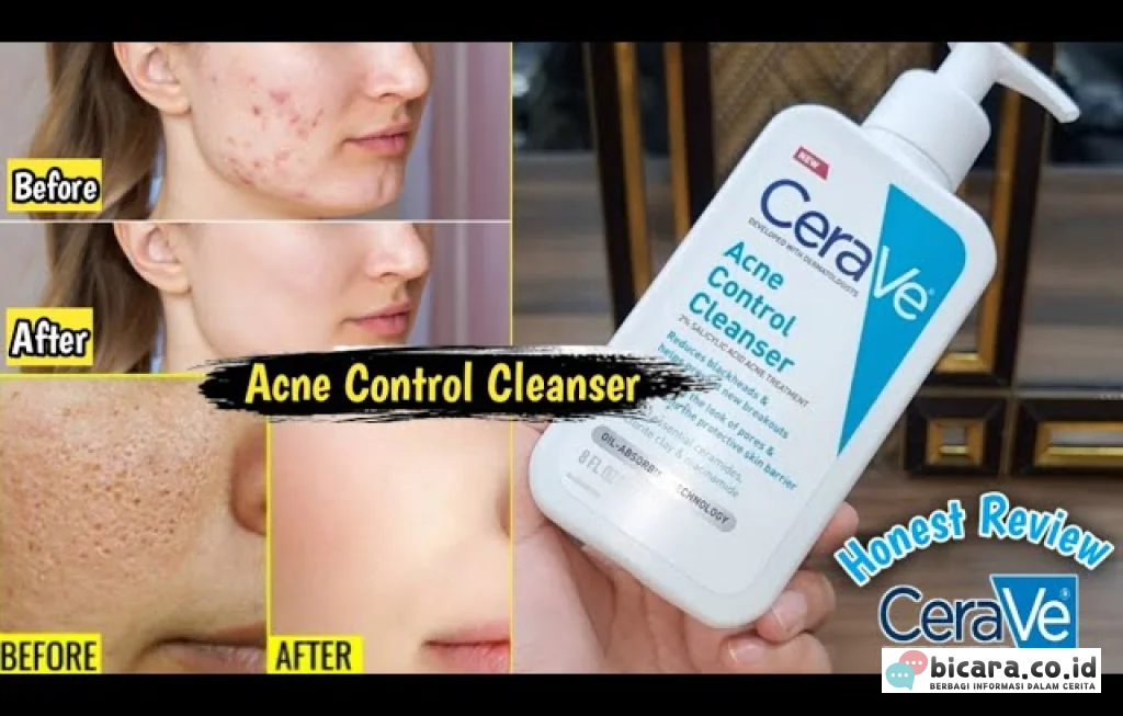 CeraVe Acne Cleanser Review