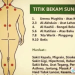 bekam dalam Islam