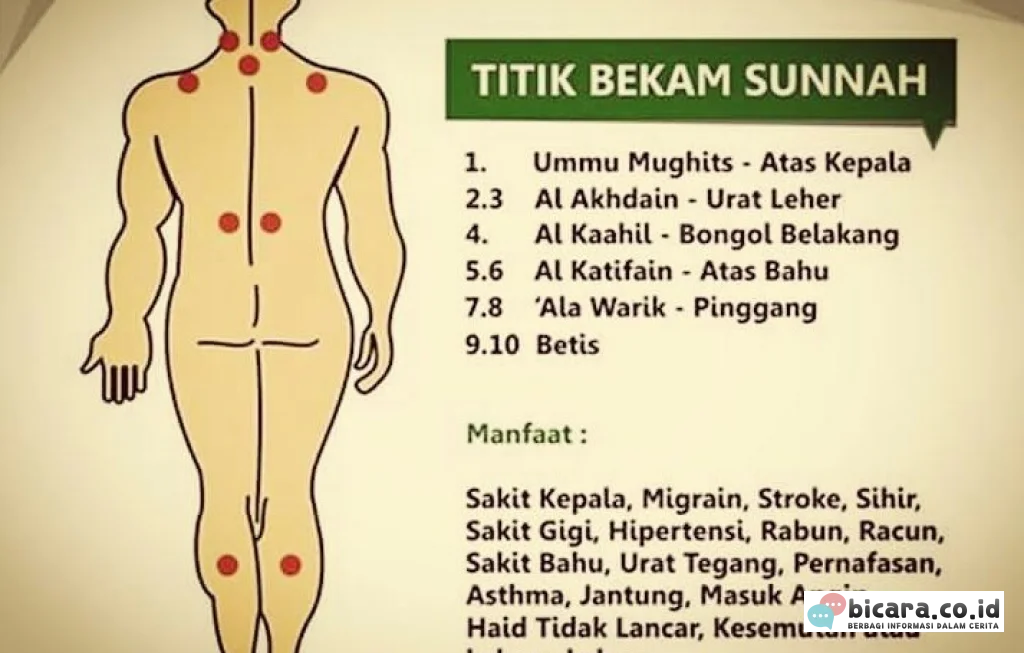 bekam dalam Islam